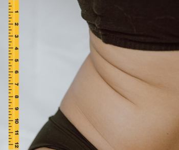 reducerea celulitei reducerea-grasimii-abdominale